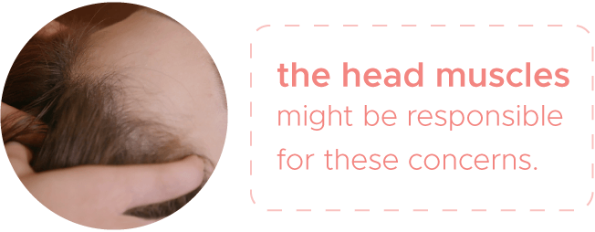 These concerns may be caused by the head muscles!