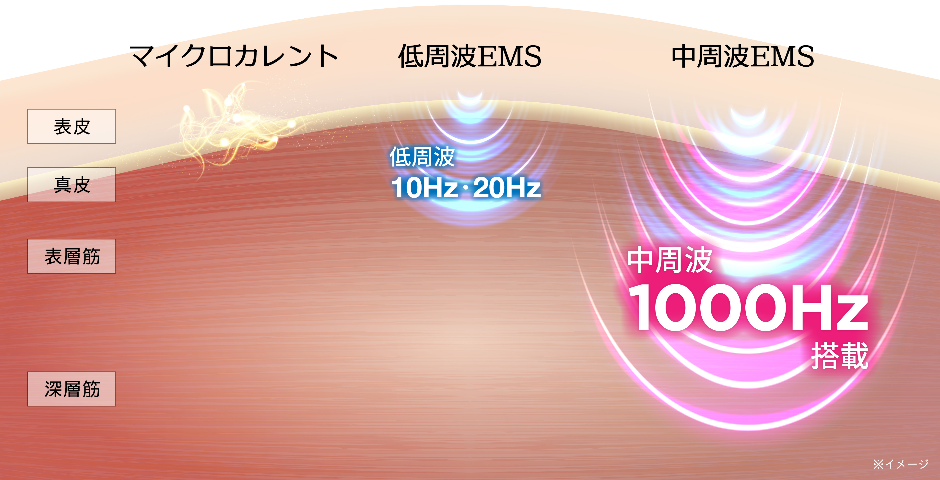 EMSの種類
