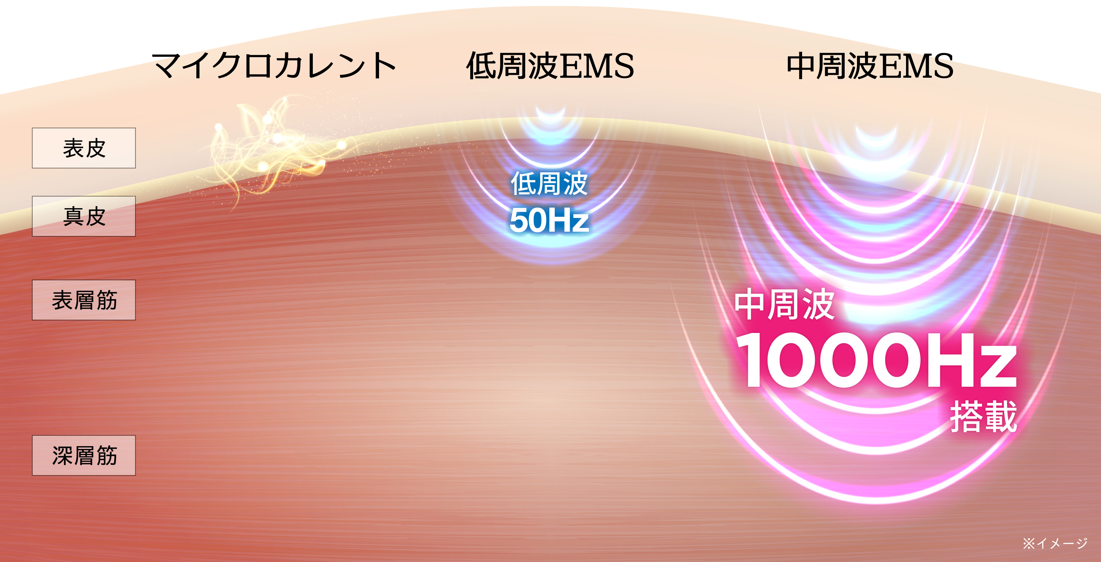 EMS・エレクトロカレントの説明図