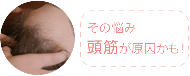 その悩み頭筋が原因かも!